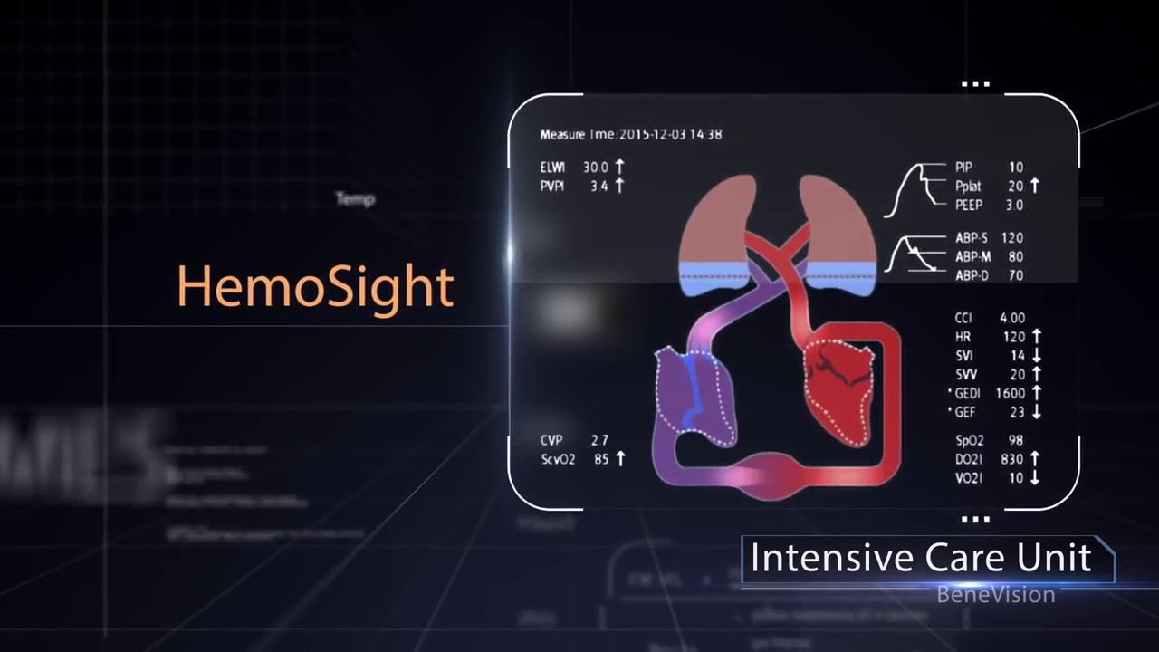HemoSight